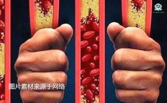 不想給血管&ldquo;添堵&rdquo;，盡量少吃以下這些東西，或許能讓腦梗離遠些  